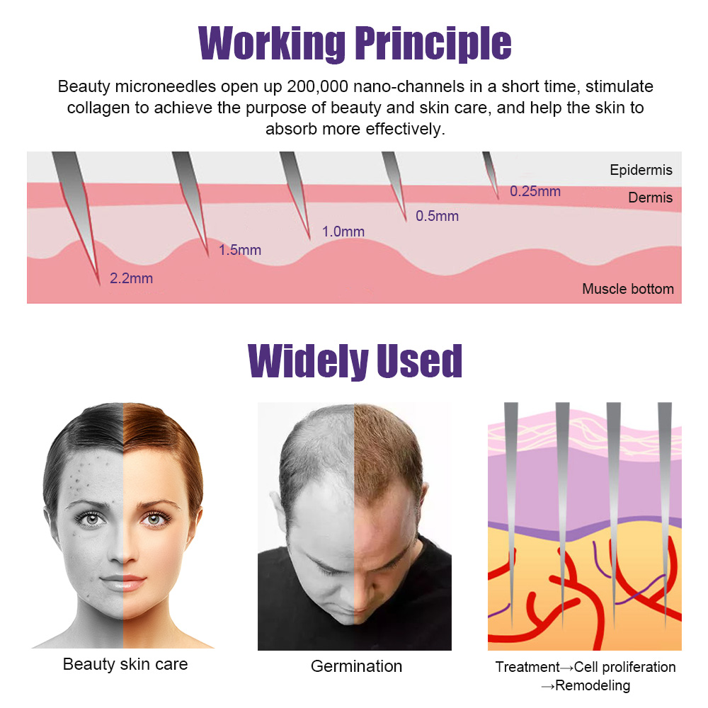 Men Tự Nhiên Mọc Râu Derma Rol - đánh giá và giá Derma Roller 0.25
