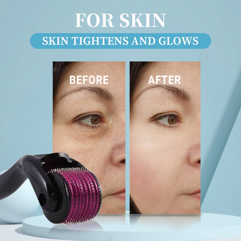 Professional 540 Roller Derma  - đánh giá và giá Derma Roller 0.25