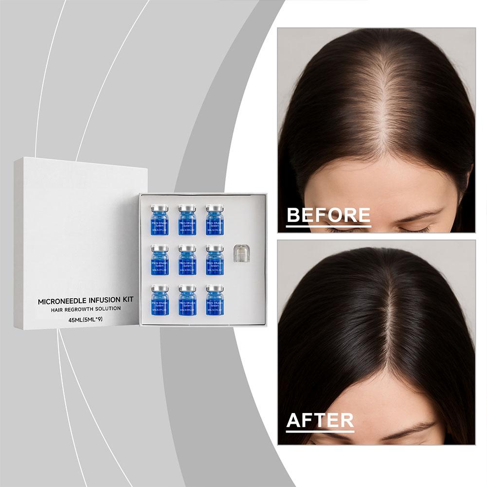 0.25mm Hair Essential Serum Mi - đánh giá và giá Derma Roller 0.25